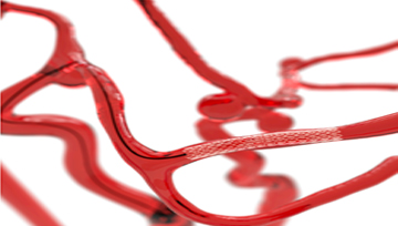 3D 혈관 시뮬레이터 및 투시 조영술 X-ray 사진2